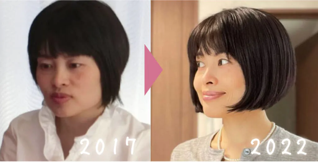 自身の身体で美容鍼&整体、鍼灸を検証しています